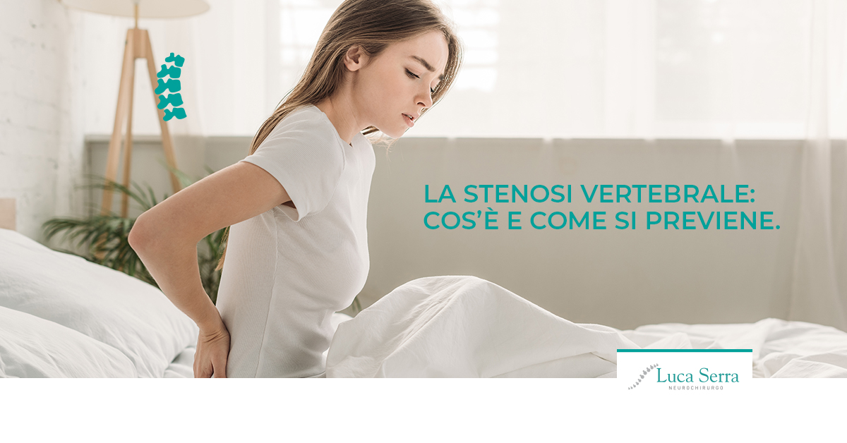 stenosi-vertebrale-come-prevenire-luca-serra