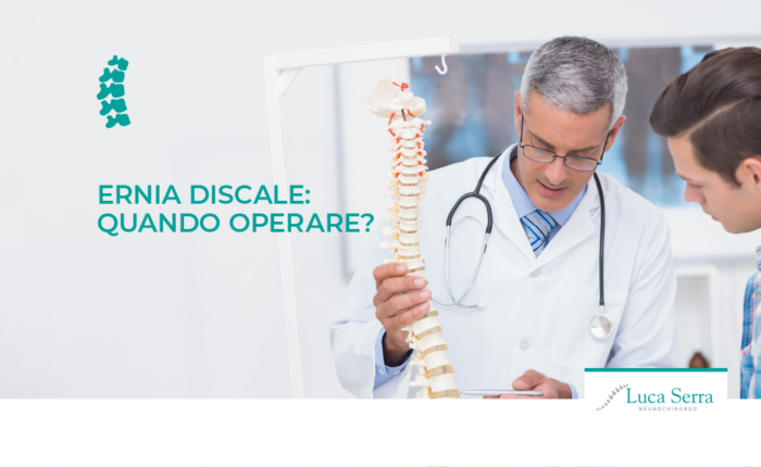 ernia discale quando operare luca serra neurochirurgo