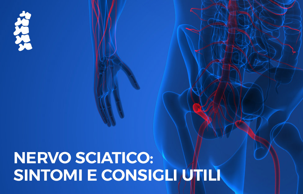 luca serra neurochirurgia infiammazione nervo sciatico